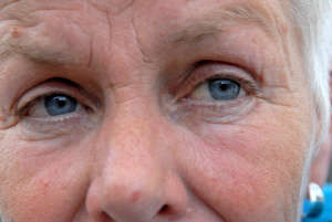 (사진제공=안성열 성형외과)